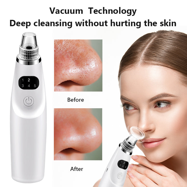 Electric Blackhead Remover Vacuum Suction Tool