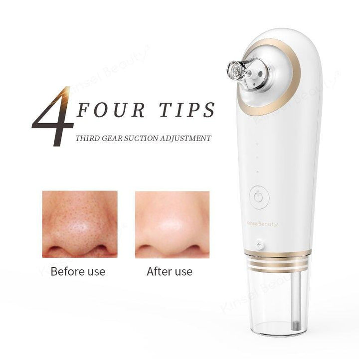 Revolutionary Blackhead Vacuum Remover