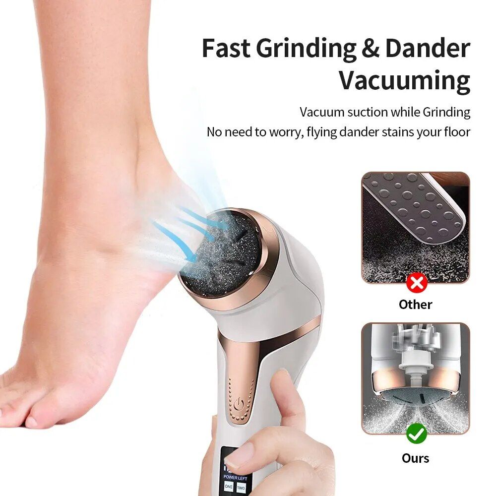 Rechargeable Electric Foot Callus Remover: Portable Pedicure Tool for Smooth Feet