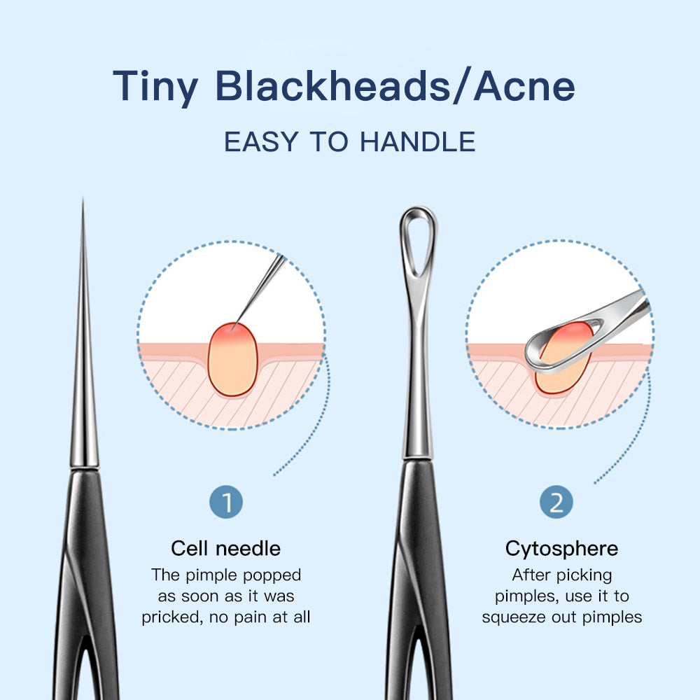 Professional Blackhead & Acne Extractor Tool for Clearer Skin