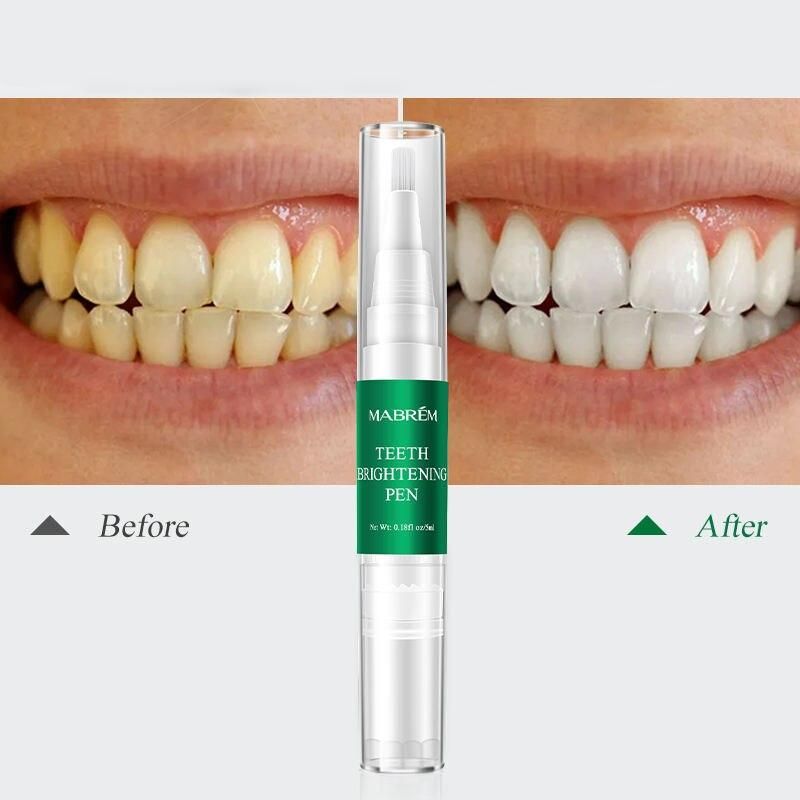 Instant Teeth Whitening Pen