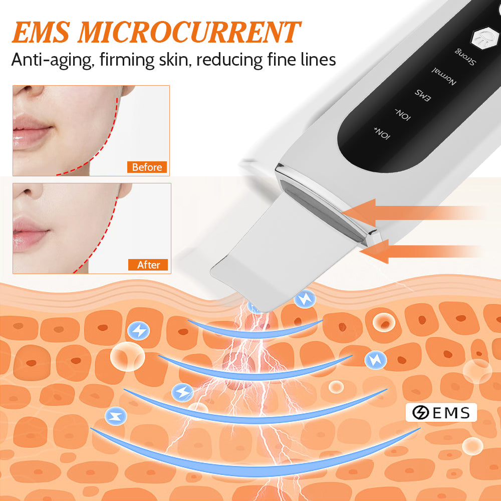 Ultrasonic Facial Peeling Machine