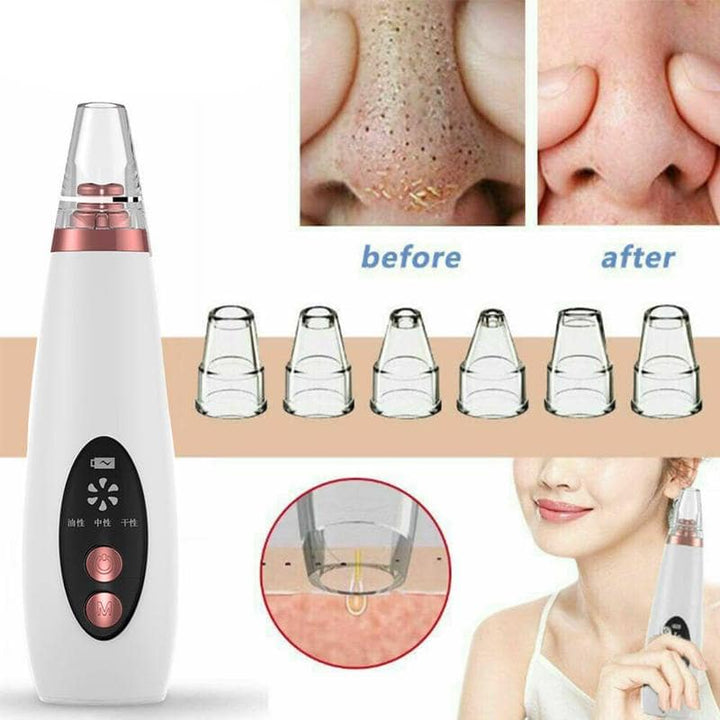 Electric Rechargable Blackhead Remover