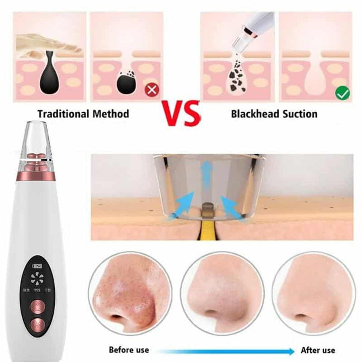 Electric Rechargable Blackhead Remover